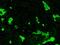 Fibrinogen Alpha Chain antibody, GTX03343-21, GeneTex, Immunohistochemistry paraffin image 