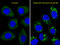 Microtubule Associated Protein 1 Light Chain 3 Beta antibody, LS-C165711, Lifespan Biosciences, Immunofluorescence image 