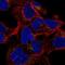 Polypeptide N-Acetylgalactosaminyltransferase 8 antibody, NBP2-57906, Novus Biologicals, Immunofluorescence image 