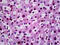 Serum/Glucocorticoid Regulated Kinase 1 antibody, 51-803, ProSci, Immunohistochemistry paraffin image 