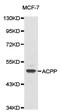 Acid Phosphatase, Prostate antibody, LS-C192681, Lifespan Biosciences, Western Blot image 