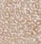 Protein Phosphatase 1 Regulatory Subunit 3B antibody, NBP1-82243, Novus Biologicals, Immunohistochemistry frozen image 