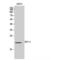 Bone Marrow Stromal Cell Antigen 2 antibody, LS-C387694, Lifespan Biosciences, Western Blot image 