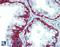 Keratin 5 antibody, LS-B3359, Lifespan Biosciences, Immunohistochemistry paraffin image 