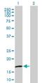 Crystallin Gamma D antibody, H00001421-B01P, Novus Biologicals, Western Blot image 