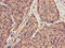 Small Ubiquitin Like Modifier 3 antibody, orb53115, Biorbyt, Immunohistochemistry paraffin image 