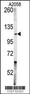 ABL Proto-Oncogene 1, Non-Receptor Tyrosine Kinase antibody, 63-154, ProSci, Western Blot image 