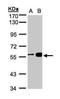 Regulator Of Chromosome Condensation 2 antibody, GTX107094, GeneTex, Western Blot image 
