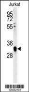 Transcription Factor AP-4 antibody, 61-931, ProSci, Western Blot image 