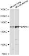 Death-associated protein kinase 1 antibody, STJ28308, St John