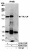 TBC1 Domain Family Member 9 antibody, NB100-55321, Novus Biologicals, Immunoprecipitation image 