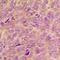 Vav Guanine Nucleotide Exchange Factor 2 antibody, orb315740, Biorbyt, Immunohistochemistry paraffin image 