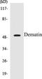 Dematin Actin Binding Protein antibody, EKC1169, Boster Biological Technology, Western Blot image 