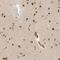 Zinc Finger MYM-Type Containing 6 antibody, HPA011004, Atlas Antibodies, Immunohistochemistry paraffin image 