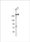 Rearranged L-Myc Fusion antibody, PA5-72260, Invitrogen Antibodies, Western Blot image 