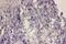 FOXP3 antibody, RP1032, Boster Biological Technology, Immunohistochemistry paraffin image 