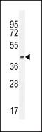 Immunoglobulin Heavy Constant Gamma 1 (G1m Marker) antibody, PA5-24440, Invitrogen Antibodies, Western Blot image 