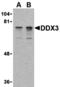 DEAD-Box Helicase 3 X-Linked antibody, A00751-2, Boster Biological Technology, Western Blot image 