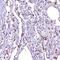 Ovochymase 1 antibody, PA5-59121, Invitrogen Antibodies, Immunohistochemistry paraffin image 