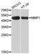 Matrix Metallopeptidase 1 antibody, LS-C331338, Lifespan Biosciences, Western Blot image 