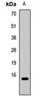 C-C Motif Chemokine Ligand 21 antibody, LS-C668103, Lifespan Biosciences, Western Blot image 