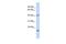 TBC1 Domain Family Member 21 antibody, GTX45603, GeneTex, Western Blot image 