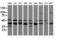 Mitogen-Activated Protein Kinase Kinase 3 antibody, LS-C787785, Lifespan Biosciences, Western Blot image 
