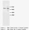 BRCA1 Associated Protein 1 antibody, LS-C171039, Lifespan Biosciences, Western Blot image 