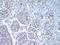 Nucleotide Binding Oligomerization Domain Containing 2 antibody, LS-C663079, Lifespan Biosciences, Immunohistochemistry paraffin image 