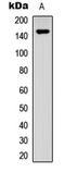 Inositol Polyphosphate-5-Phosphatase D antibody, LS-C356127, Lifespan Biosciences, Western Blot image 