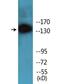 Inositol Polyphosphate-5-Phosphatase D antibody, LS-C291632, Lifespan Biosciences, Western Blot image 