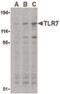 Toll Like Receptor 7 antibody, PA5-20053, Invitrogen Antibodies, Western Blot image 