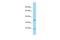 Protein RGD1306739 antibody, A30244, Boster Biological Technology, Western Blot image 