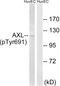 AXL Receptor Tyrosine Kinase antibody, LS-C198665, Lifespan Biosciences, Western Blot image 