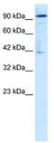 OTU Deubiquitinase 7B antibody, TA337240, Origene, Western Blot image 