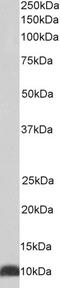 Epoxide Hydrolase 2 antibody, 43-708, ProSci, Western Blot image 