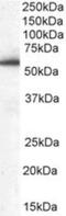 Drebrin Like antibody, NB100-1036, Novus Biologicals, Western Blot image 