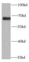 Proline dehydrogenase, mitochondrial antibody, FNab06796, FineTest, Western Blot image 