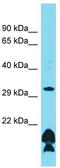 Olfactory Receptor Family 51 Subfamily B Member 5 antibody, TA334835, Origene, Western Blot image 