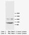 Phospholamban antibody, LS-C171976, Lifespan Biosciences, Western Blot image 