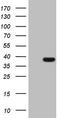 Thiamine Triphosphatase antibody, LS-C790781, Lifespan Biosciences, Western Blot image 