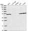 Solute carrier family 25 member 46 antibody, NBP2-58085, Novus Biologicals, Western Blot image 