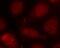 Protein Kinase C Beta antibody, ab75657, Abcam, Immunofluorescence image 