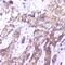 Survival Of Motor Neuron 2, Centromeric antibody, M03420-1, Boster Biological Technology, Immunohistochemistry paraffin image 