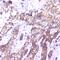 SMN antibody, M03420-1, Boster Biological Technology, Immunohistochemistry paraffin image 