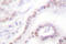 Thyroid Hormone Receptor Beta antibody, LS-C176246, Lifespan Biosciences, Immunohistochemistry paraffin image 