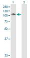 BCL6 Corepressor antibody, ab88112, Abcam, Western Blot image 
