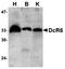 TNF Receptor Superfamily Member 6b antibody, orb74377, Biorbyt, Western Blot image 