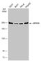 Myosin Heavy Chain 10 antibody, GTX133378, GeneTex, Western Blot image 