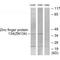 Zinc Finger Protein 134 antibody, A16407, Boster Biological Technology, Western Blot image 